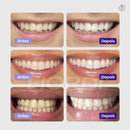 [Queima de Estoque🔥] Clareador Dentário WhitePlus™ - Sérum V34 + Brindes Exclusivos (Somente Hoje)