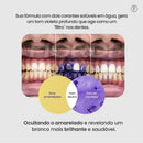 [Queima de Estoque🔥] Clareador Dentário WhitePlus™ - Sérum V34 + Brindes Exclusivos (Somente Hoje)