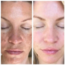 Óleo de Rosa Mosqueta BBLumix- Cuidados & Hidratação da pele™ - PopStore